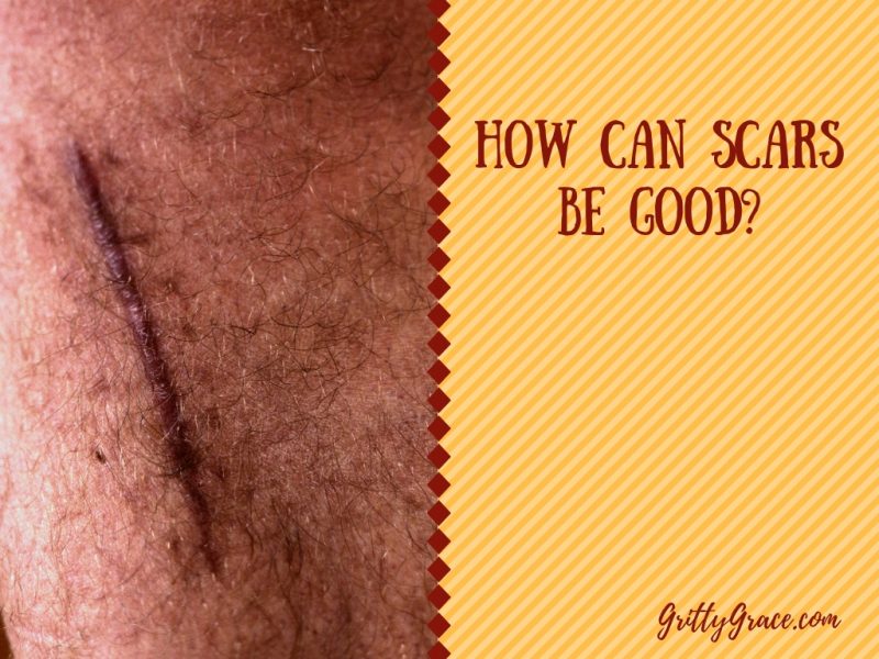 WHAT IS GOOD ABOUT SCARS?…