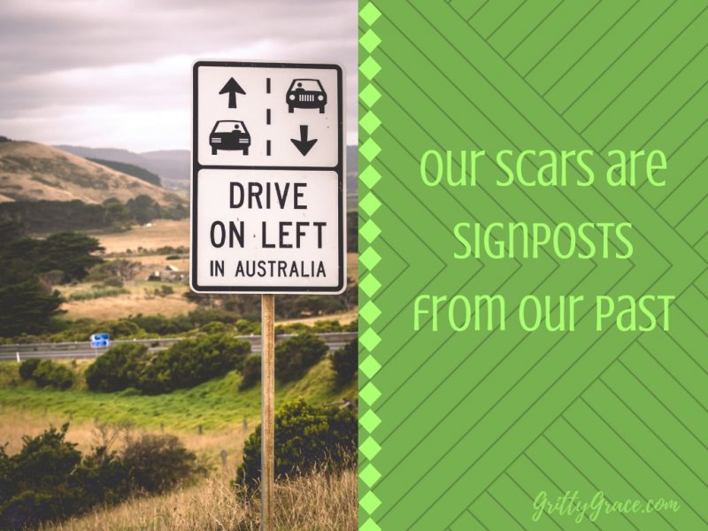 OUR SCARS ARE SIGNPOSTS FROM OUR PAST…