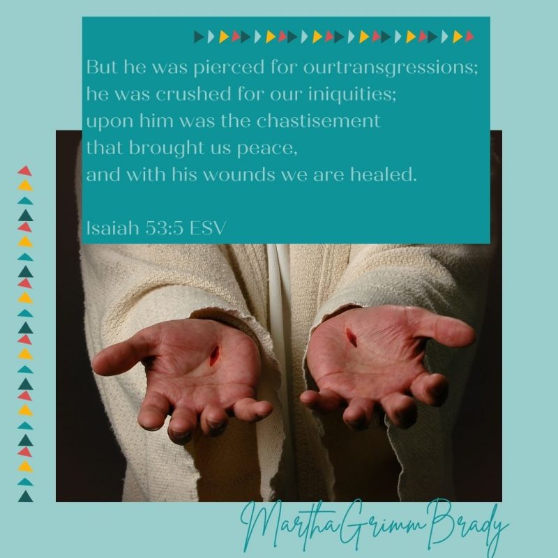 Most important scars? Those Jesus carries for me that are able to provide forgiveness and life for me as a free gift from Him. Free to me but not cheap for Him. #Jesusscarsbringhealing #Hisscarsgavemelife #christarose